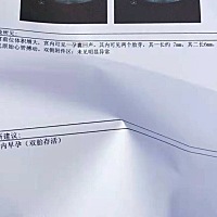 备孕三年未孕 这次终于促排成功 还怀上了双胞胎