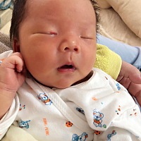 这是胎记还是什么？有没有遇到过同样问题的宝妈？会不会自己消？