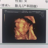 宝宝2个月啦！和四维像吗？😏