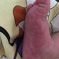 出生16天的宝宝手脚掌心出这些红点是怎么回事呢？有谁懂，求答