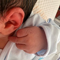 跪求各位孕妈，产后外痔用什么牌子痔疮膏效果好？这外痔快把我弄疯了！
