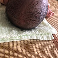 50来天的宝宝头上长了湿疹，需要摸什么吗？有碰到过这种情况的宝宝不？