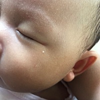 这个白色的是什么啊  长了大半个月了   又挤不掉  像痘痘   但是比痘痘硬