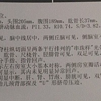 24周四维彩超，能看出男孩女孩吗