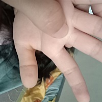 宝宝六个月就是我图片中用手指的那个地方的那，长了个包包表面看到不但是摸得到硬硬的一个小包像骨头一...