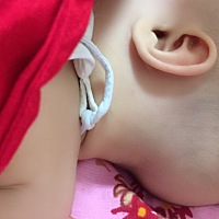 宝宝五个月了，头型一直这样，该如何做？可以纠正吗？