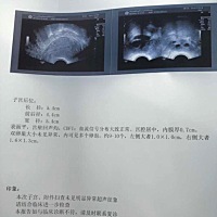 大家帮我看看…我这个排卵是9-10个，医生还问我是不是吃促排卵药了，我现在有点害怕自己是不是得多囊卵...