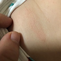宝宝身上长了一片疙疙瘩瘩的，微红，不知道是什么？有懂的宝妈吗？