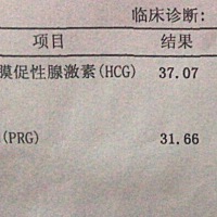 帮我看下，我昨天忍不住去抽血了。医生说还太早，叫我10号再去。
