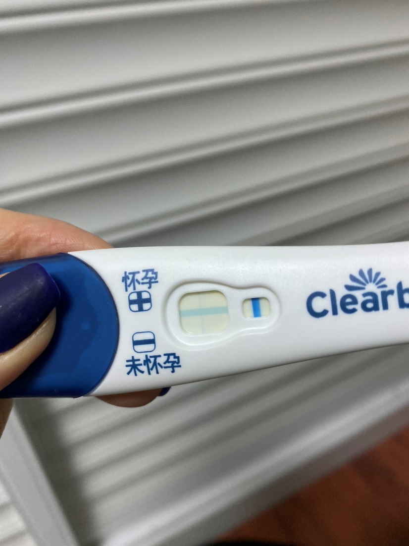 今天排卵第12天,早晨测可丽蓝湿的时候大白板,干了之后发现有个浅浅的印子,下午直接去医院验血,结果显示hcg小于1.2没有怀孕.好失望~可丽蓝真的好喜欢炸胡!