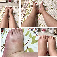 38周+4天，求发动