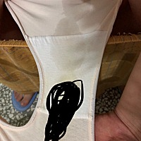 昨晚半夜醒来测了个身平躺，就有这样的水流出来，但是没有这么多，很少，今天半夜醒了，也是测了个身平...