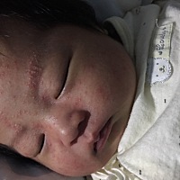 谁告诉我这是什么。几天了擦了药也下不去。