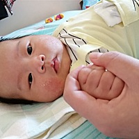 宝宝脸颊呢湿疹反复无常，之前有涂过木瓜膏没有效果，然后一直涂炉甘石抑菌洗剂，本来快好的了，近两天...