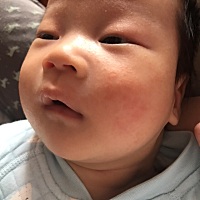 宝妈们帮我看看我家宝贝早上醒来脸上长了东西红红的一片还有点粗糙不知道怎么回事？有什么东西可以用的...
