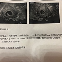 7周的时候