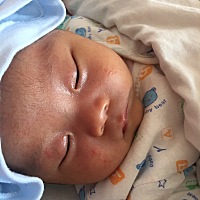 住院四天照蓝光，终于把黄疸降下来了，从407降到好170多，黄疸值如果太高的话，还是不要拖，及时治疗…...