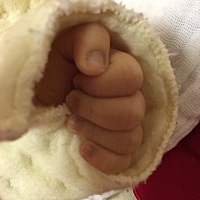 宝宝指甲根部发黑，出生25天，怎么回事，有没有类似情况的？