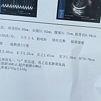 怎么才36周胎盘成熟度就3级了？有同样的宝妈吗？ 在医院医生忙了说都还可以，也就没多问……😓