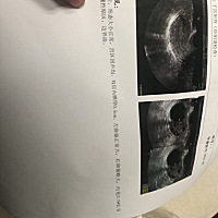 这个严重吗