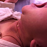 有明白的宝妈知道这是什么吗？ 孩子5天了
