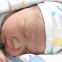 有经历过顺转剖的吗？10月18号凌晨两点肚子开始有规律的疼痛宫缩，马上收拾起来到医院，三点做了胎监，...