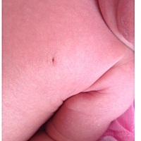 宝宝2周岁了可是乳头还是凹陷的，请问正常吗？长大后应该会长出来的吧？