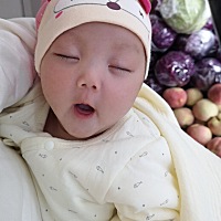 我是易瘦体质 怀孕 涨了20斤，肚子，胸，屁股都是纹； 生了孩子，刨腹刀疤也是黑黑的，体重恢复和以前 ...