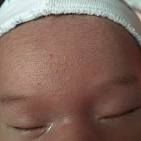 宝宝额头长的是啥，有没有宝妈知道