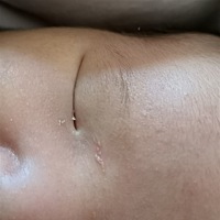 求助！有没有宝妈知道这是怎么了，长了什么东西？？