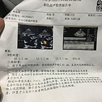 宝宝卵圆孔生下来0.4cm 现在扩大了一厘米 怎么办啊 今天有人跟我说要开胸 吓得我要死