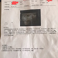 请问一下乳腺增生吃什么药好呢？现在提心吊胆的