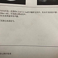 图1排20  图2今天8w 的b超，传大家宫内健康宝宝   Fsh高卵 泡发育的不好，只能在监测排卵方面执行力高...