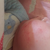 宝宝这两天脸上长了红的东西，是湿疹吗？有什么药膏能涂涂？求宝妈知道的告知