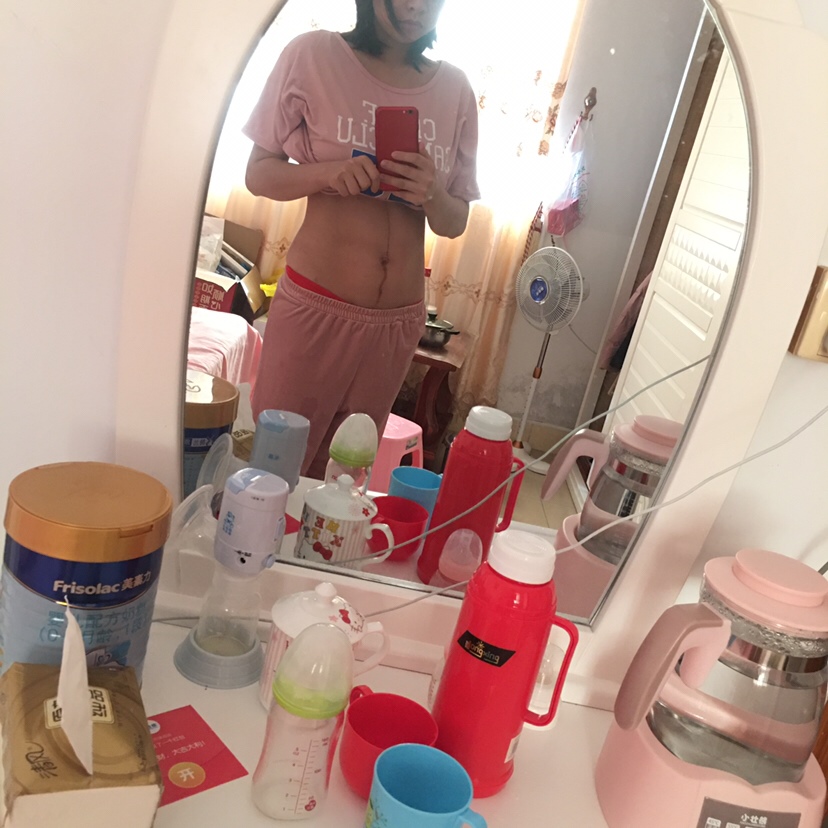 产后11天的肚子，剖腹产伤口没有完全愈合