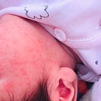 脸上，手上也有，大家有一样的吗？你们是怎么处理好的，求方法！