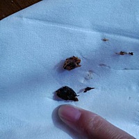 宝宝耳垢清理，我有绝招，图片有点恶心慎入 我家宝宝最近耳朵痛，一照耳朵，发现结了一层很厚很厚的耳垢...