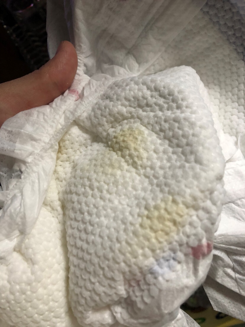 有遇到这种情况的吗？纯母乳喂养的