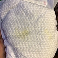 前几天突然小便带淡红色，并且拉肚子两天，过了几天了，宝宝没拉肚子了，小便却带有黄色，纯母乳喂养的...