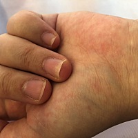 有没有孕期指甲这样的