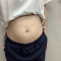 生之前和生之后第六天的肚子，求招 恶露感觉有味道 生前94斤，现在110斤