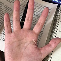 手相上看，手心色泽红润，有青筋显露，要注意肠胃方面的问题，感情线直至中指与食指之间，说明你很重感...