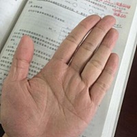 掌纹为智慧型假断掌，上方出现理财纹，具有理财守财的概念与方法，其人可拥有财富，聚财能力强，胆大心...