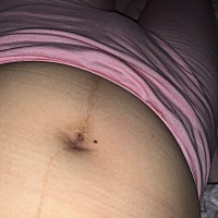 瘦了好多 月子里吃不下 心情不好 母乳也不足 贴的奶粉喂养……