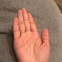 掌心有痣，主富贵，同时也是个能力强的治理者，属于心思缜密、计算精确之流，最适宜当工程师、法官或者...