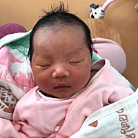 宝宝生下来第二天就有了眉毛下和额头上像胎记一样的，有宝妈知道这是什么吗？不知道长大了会不会消失？？