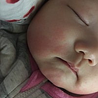 现在宝宝满脸都是湿疹 用过肤乐霜 用过戒之馆的去湿疹的 都不行 怎么才能去除呀 ？我又怕这些药用多了对...