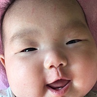 我家宝宝三个月的时候 牙龈上就冒出了小白点 我以为是马牙 后来去医院医生说是牙齿 三个多月长牙是不是...