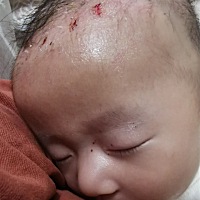 头部长皮估计是痒，自己抓破了，朋友介绍后。涂了仙人掌种子油，现在好多了。必须给个赞这瓶油，当妈妈...