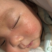 帮忙看看儿的脸这是怎么了 请问宝宝脸上这是怎么了，我怕宝宝冷，这几天在屋里开的暖风机，今天刚买的婴...